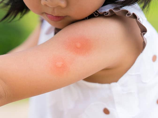 infected mosquitoes can transmit illness through mosquito bites